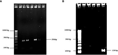 Evaluation of bacteriophage therapy of Aeromonas hydrophila infection in a freshwater fish, Pangasius buchanani
